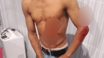 Anak di bawah umur terlibat keributan penusukan pesta di blora